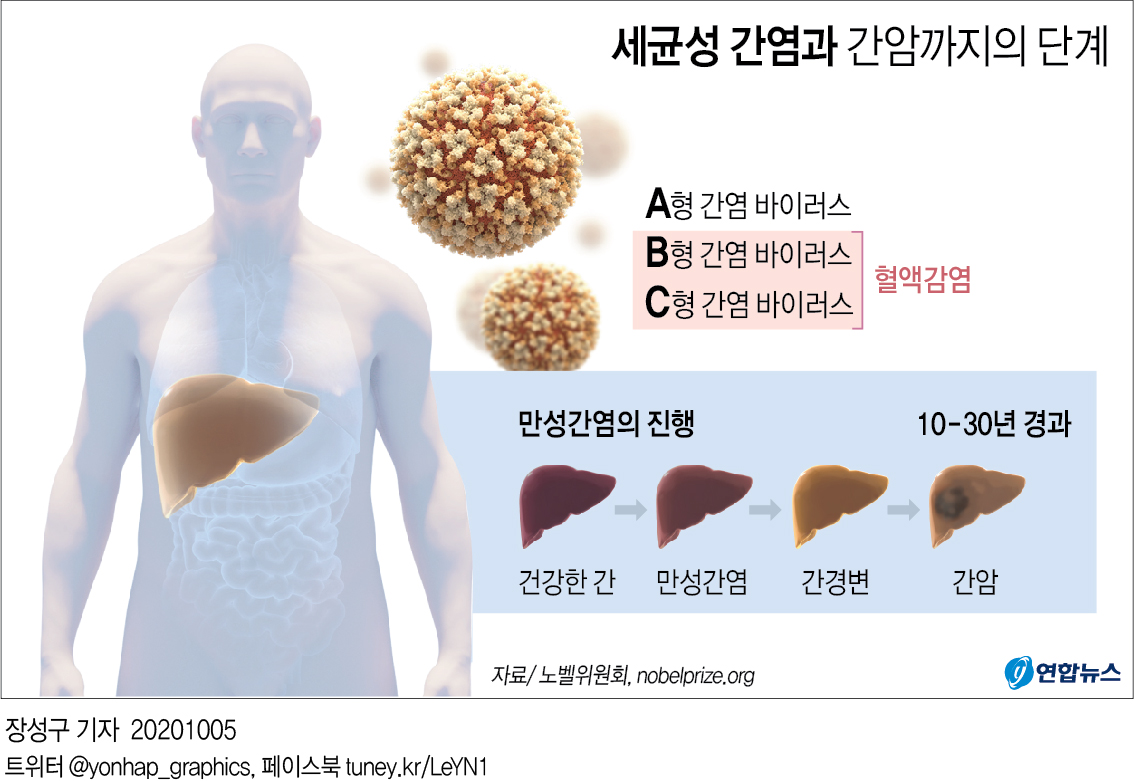 "C형간염 종식에 희망"…미·영 학자 3명에 노벨의학상(종합2보) - 3