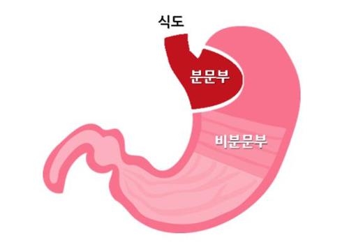 B형·AB형, 다른 혈액형보다 위암 걸릴 확률 낮다 - 2