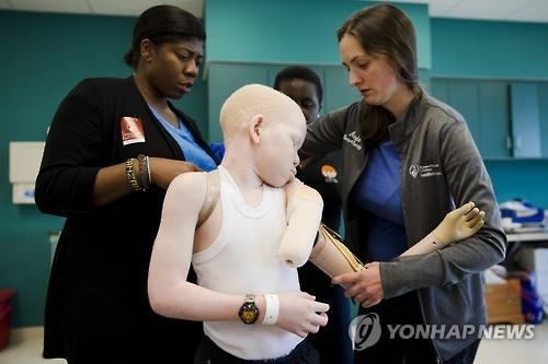 '하얀 흑인' 탄자니아 백색증 환자 "우리도 똑같은 사람" - 7