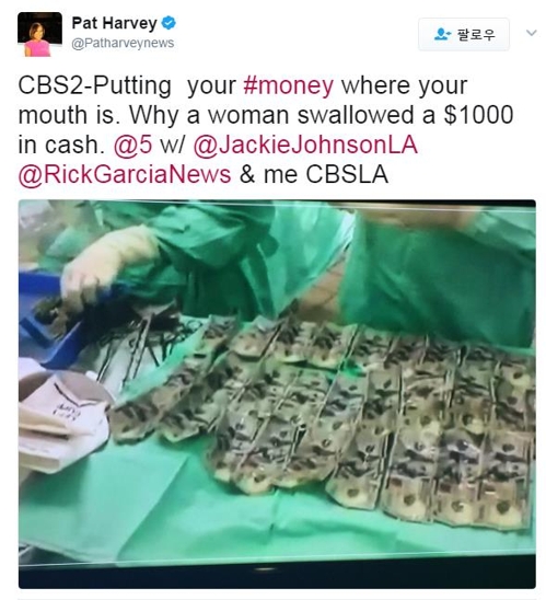뱃속에서 꺼낸 100달러 지폐