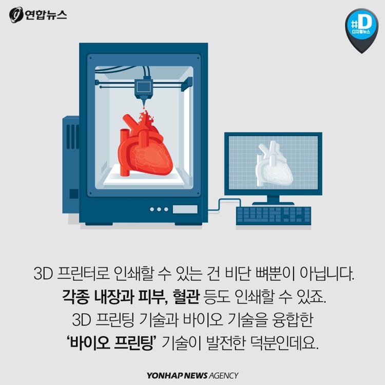 [카드뉴스] 혈관·뼈·내장 3D 프린팅 시대…장기이식 혁명 오나 - 3