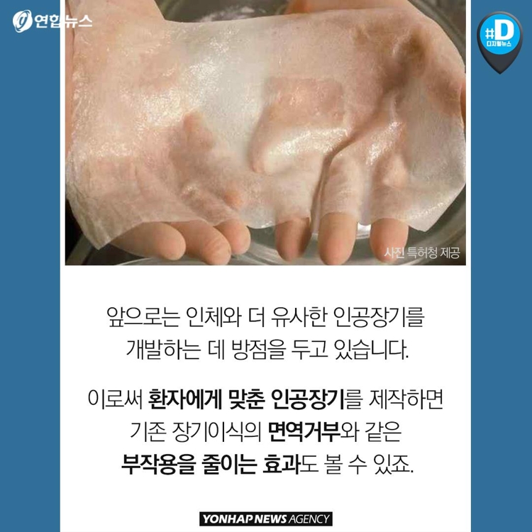 [카드뉴스] 혈관·뼈·내장 3D 프린팅 시대…장기이식 혁명 오나 - 12