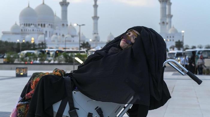27년 만에 혼수상태서 깨어난 UAE 여성