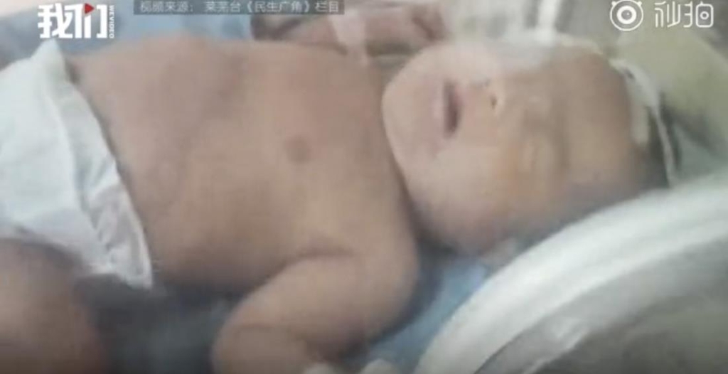 중국서 생매장된 후 구조돼 건강하게 자라고 있는 아기