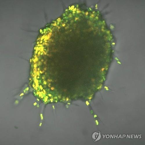 형광 바이오센서로 추적한 암세포 종양. 에너지를 많이 쓸수록 더 밝다.