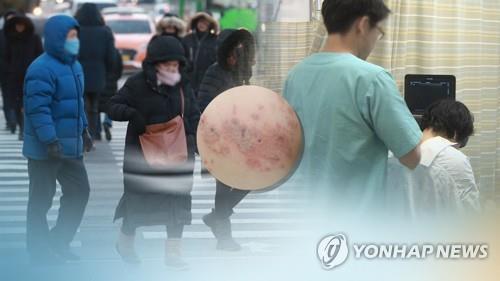 대상포진 CG