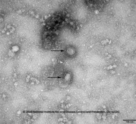 전자현미경을 통해 본 중국 우한 코로나바이러스