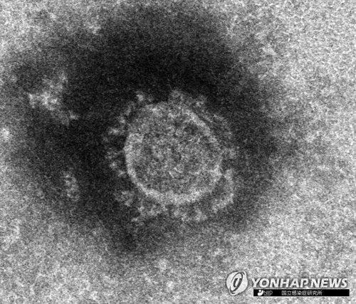 신종 코로나바이러스의 전자현미경 사진[일본 국립감염증연구소 제공, 재판매 및 DB 금지] 