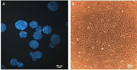 섬유아세포 배양 사진(왼쪽 3차원 기술배양, 오른쪽 2차원 기술배양) 