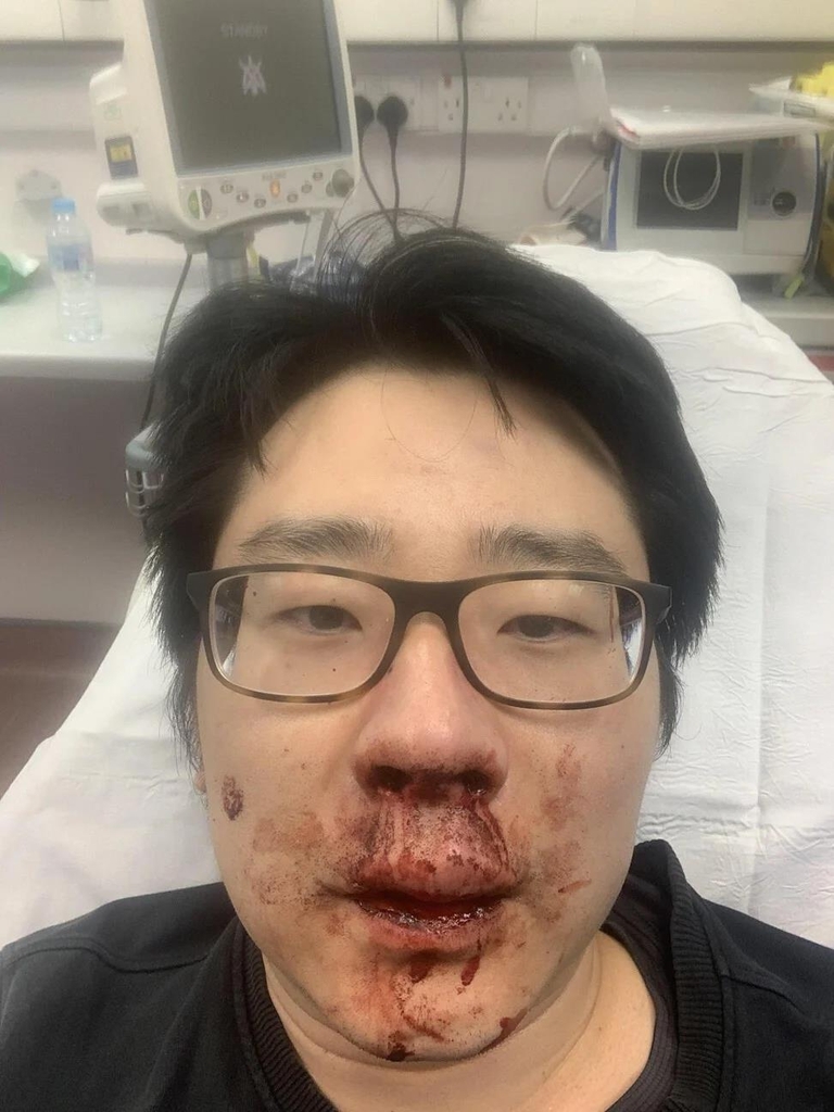 영국에서 폭행당한 중국인 강사 펑 왕.[사우스차이나모닝포스트 사진. 재판매 및 배포 금지] 