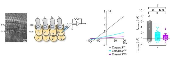 TMEM43 정상 쥐(회색)와 돌연변이 쥐(보라색)의 전기 신호 변화