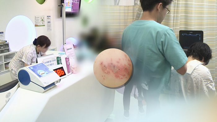 불청객 '명절 증후군'…대상포진·화병 주의보