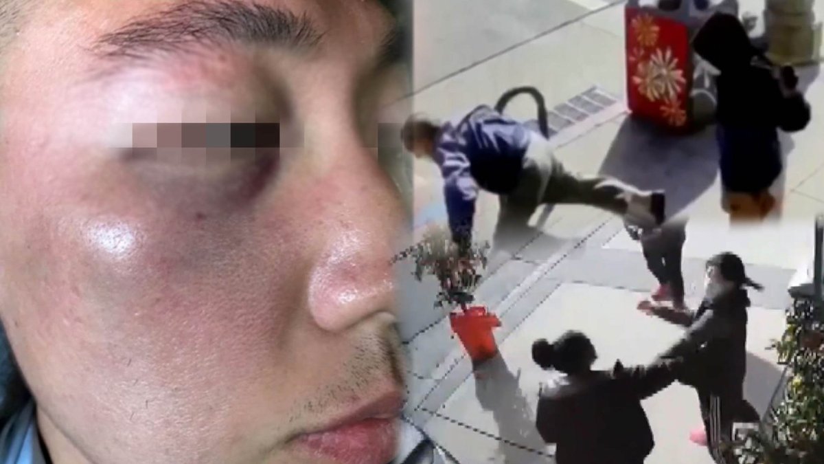 "중국 바이러스" 한인 무차별 폭행…美 혐오범죄 잇따라