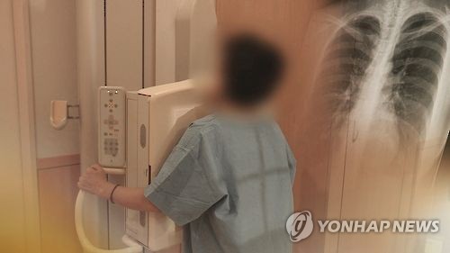 폐암 국가암검진에 포함(CG)