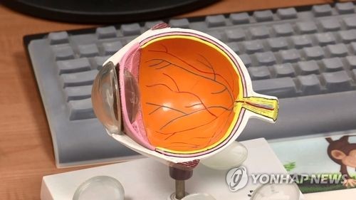 안구 모형