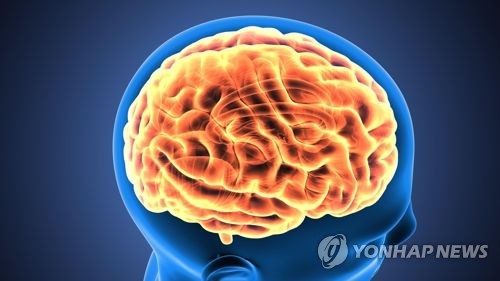 인간 뇌