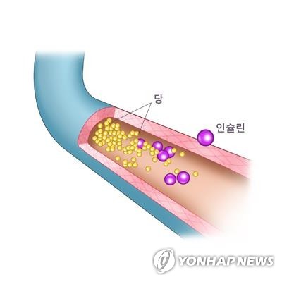 당뇨병 설명도