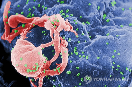 세포 표면에 붙어 있는 HIV-1 바이러스