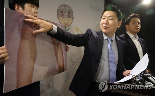 구타의심 제기하는 김대희 교수