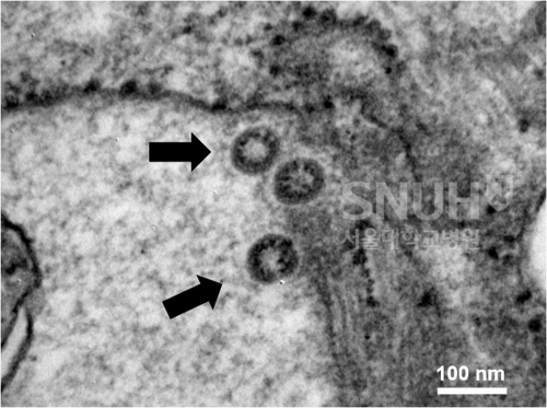 新型コロナウイルスを分離　韓国の研究チームが電子顕微鏡写真