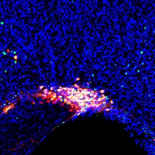 전신마취 상태에서 활성화한 시삭상핵 뉴런(붉은색 부분)