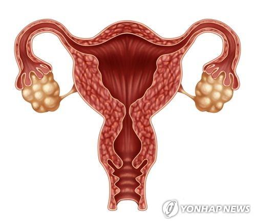자궁과 난소