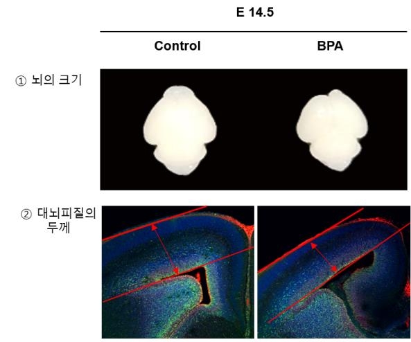 BPA 노출이 뇌 발달과 대뇌피질 두께에 미치는 영향 실험