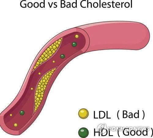 '나쁜' 콜레스테롤(LDL)과 '좋은' 콜레스테롤(HDL)