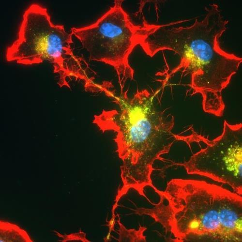 소교세포의 분업 메커니즘