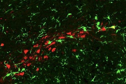 뇌의 노화 세포를 공격하는 성상교세포 