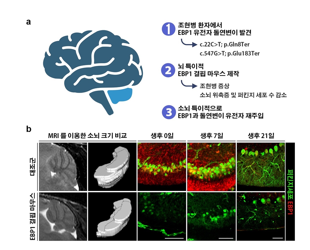 Ebp1 결핍 마우스를 이용한 조현병 연구 개념도