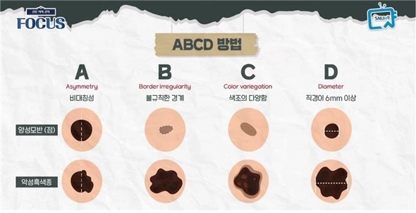 ABCD 자가진단 체크포인트
