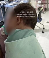 CCTV 없는 중환자실서 신생아 학대 혐의 간호사 3명 송치