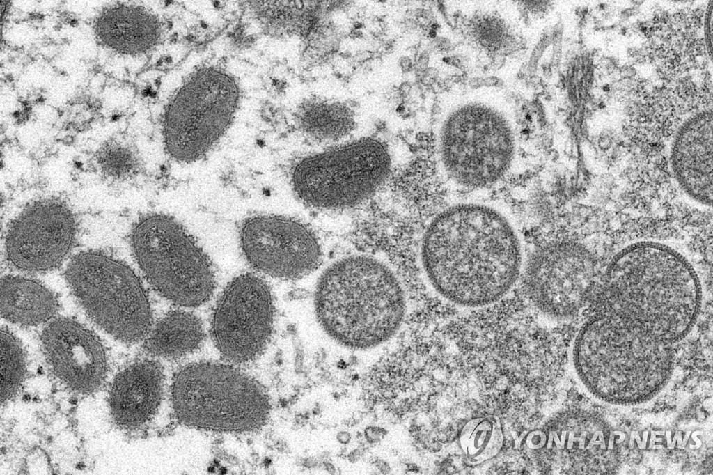 원숭이두창 바이러스 입자 전자현미경 이미지.