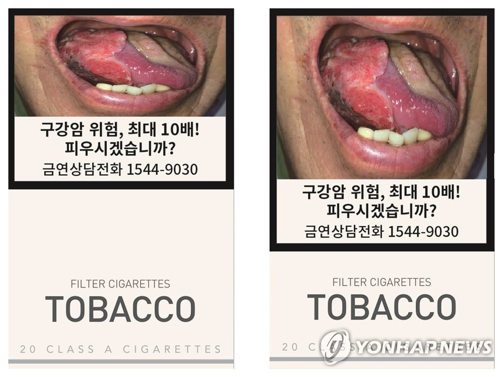 This file photo released by the health ministry in July 2019 shows the heightened risk of smokers contracting oral cancer. (PHOTO NOT FOR SALE) (Yonhap)