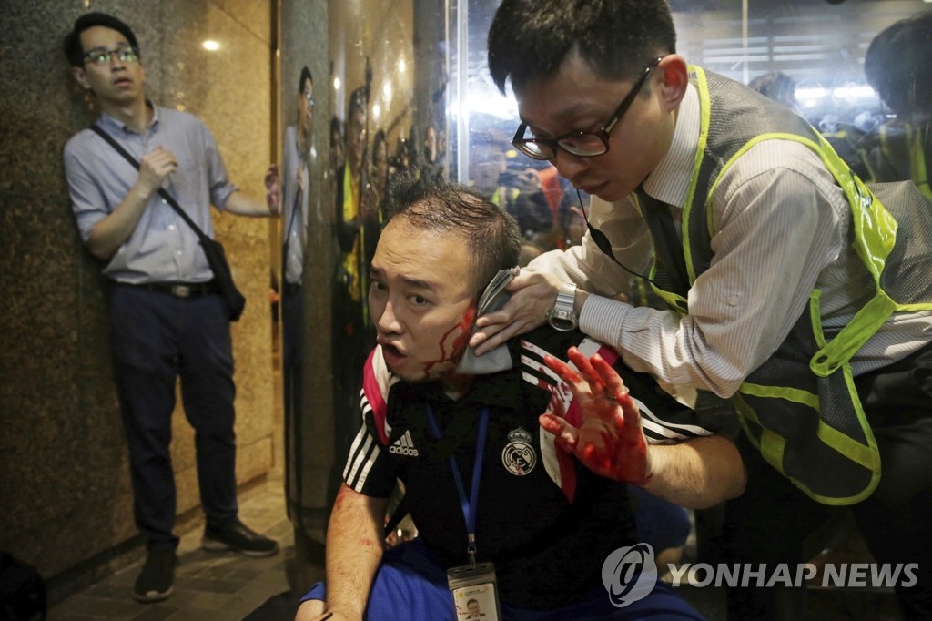 반정부 시위장서 공격 당한 홍콩 구의원